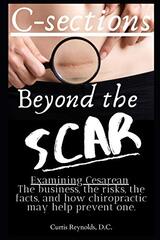 C-sections: Beyond the Scar: Examining Cesarean